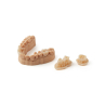 Couronne temporaire dentaire impression 3D Couronne temporaire dentaire impression 3D
