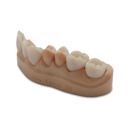 FInition VITA Formlabs - couronne unitaire FInition VITA Formlabs - couronne unitaire