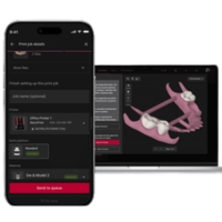 SprintRay NanoPrint - Logiciel connecté et suivi des impressions