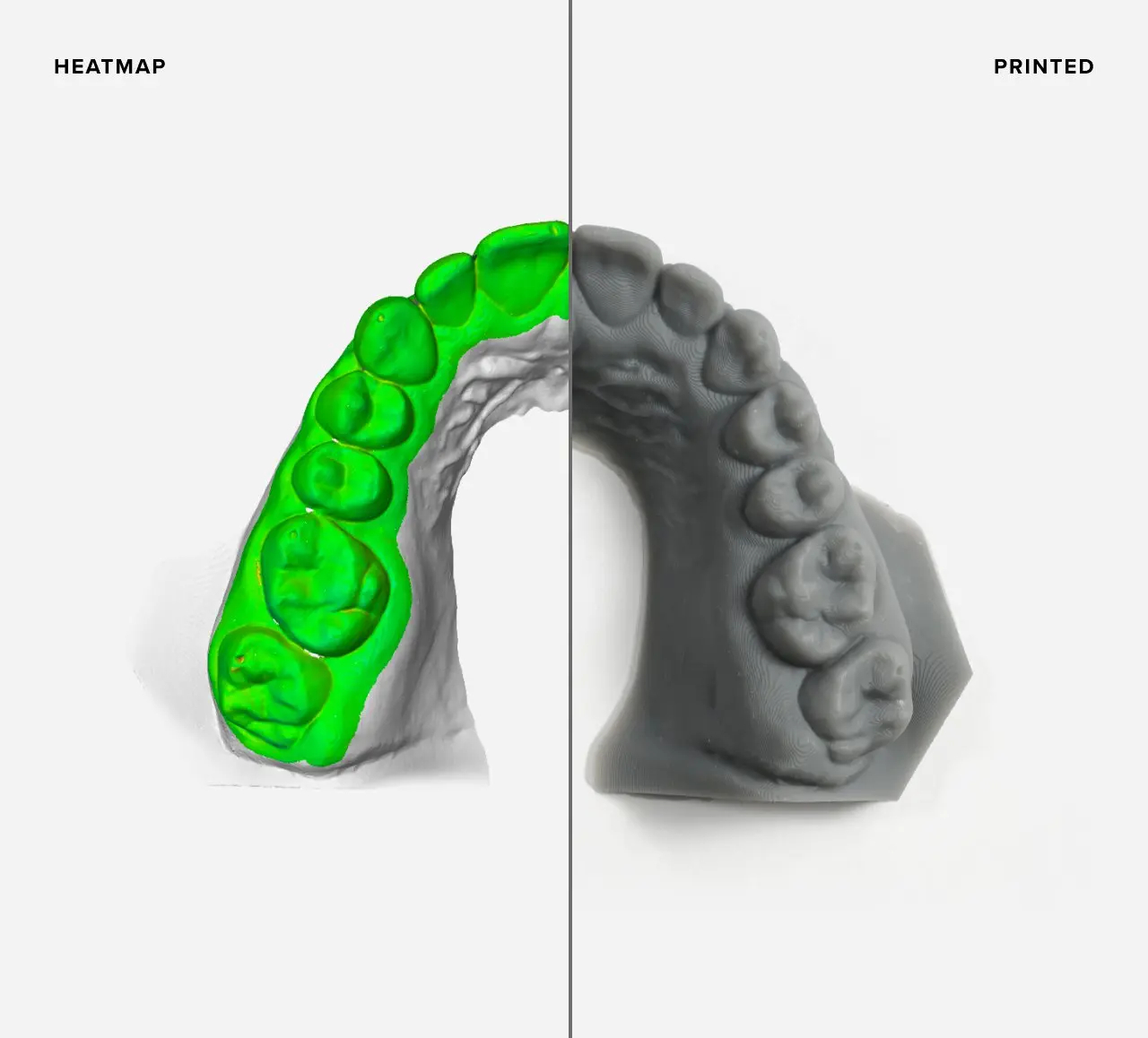 Formlabs Form 3B modèle orthodontique