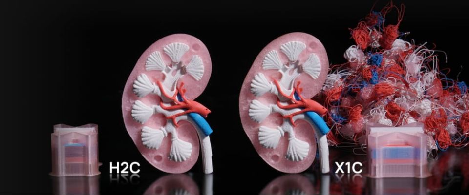 Vortek System comparison